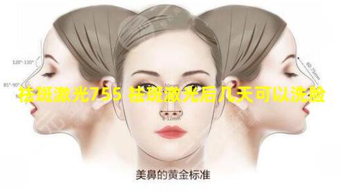 祛斑激光755 祛斑激光后几天可以洗脸
